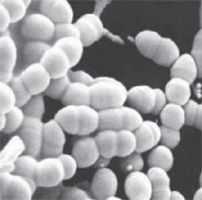 Молочная кислота. Друг или все-таки враг? Молочная кислота. Друг или все-таки враг?