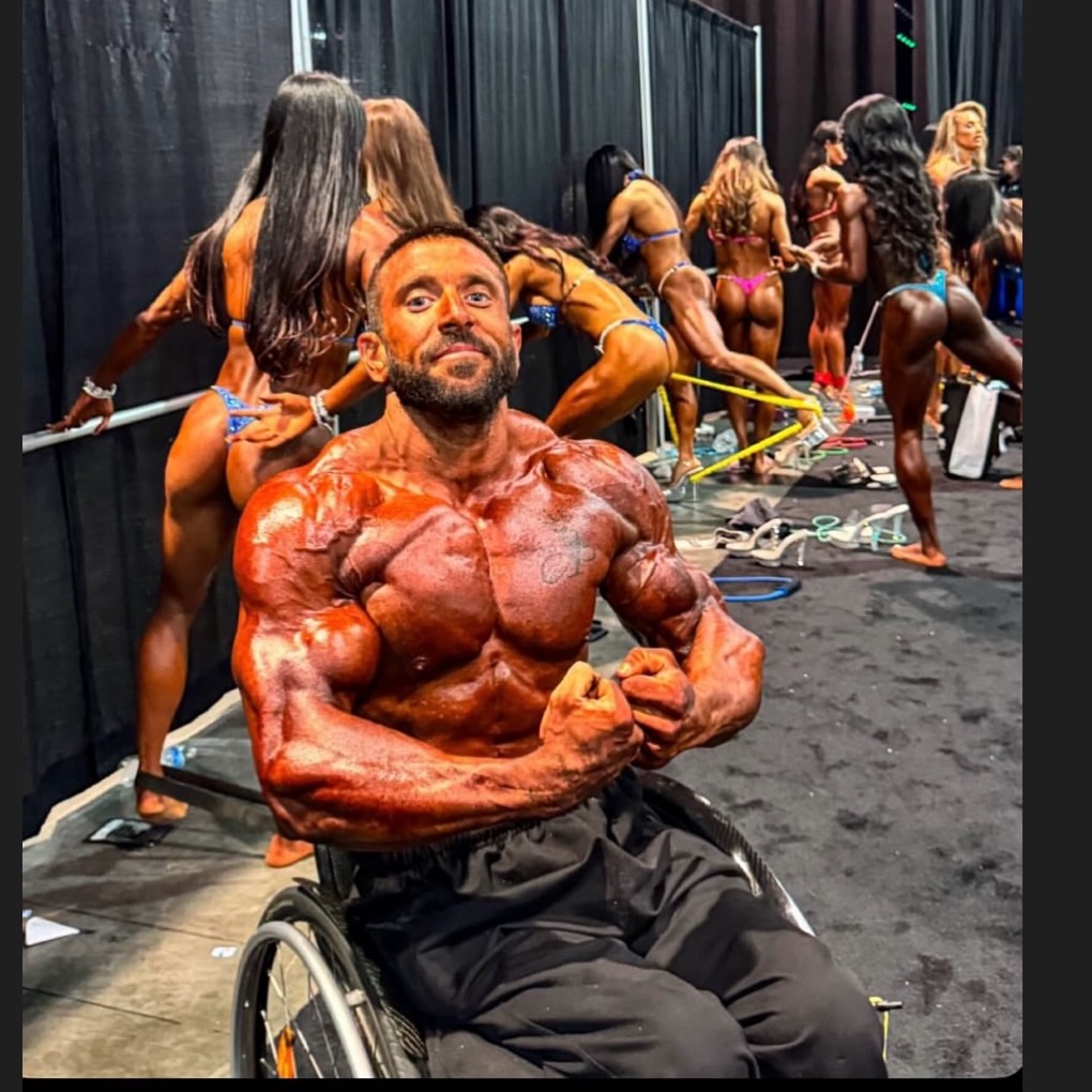 Антонио Матковис