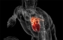 Коэнзим Q10 предотвращает и лечит болезни сердца