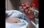 Стероиды довели бодибилдера-блогера до ампутации ноги